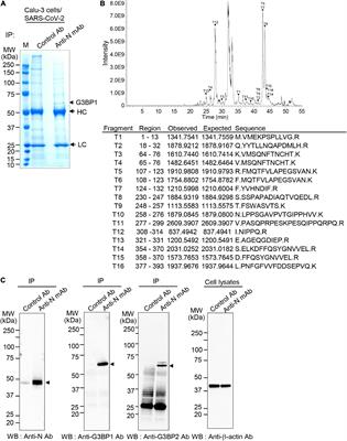 Differential effect of SARS-CoV-2 infection on stress granule formation in Vero and Calu-3 cells